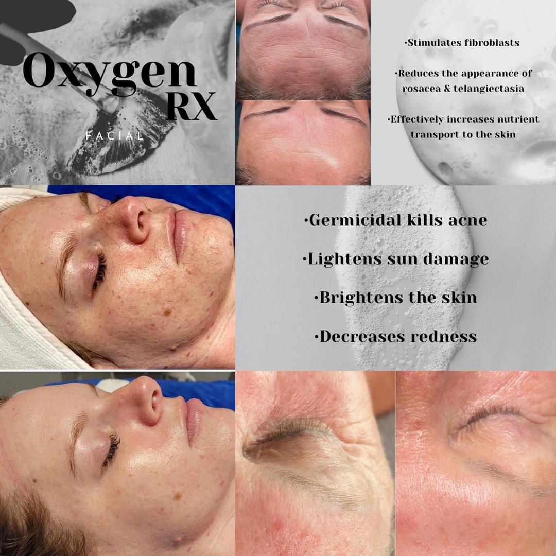 Oxygen facial