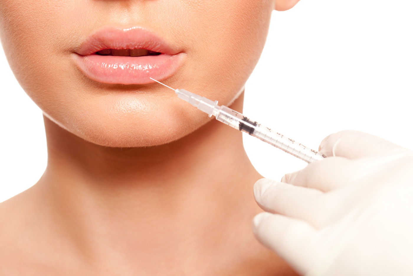 Microchanneling/Microneedling