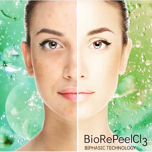 BioRePeel before & after
