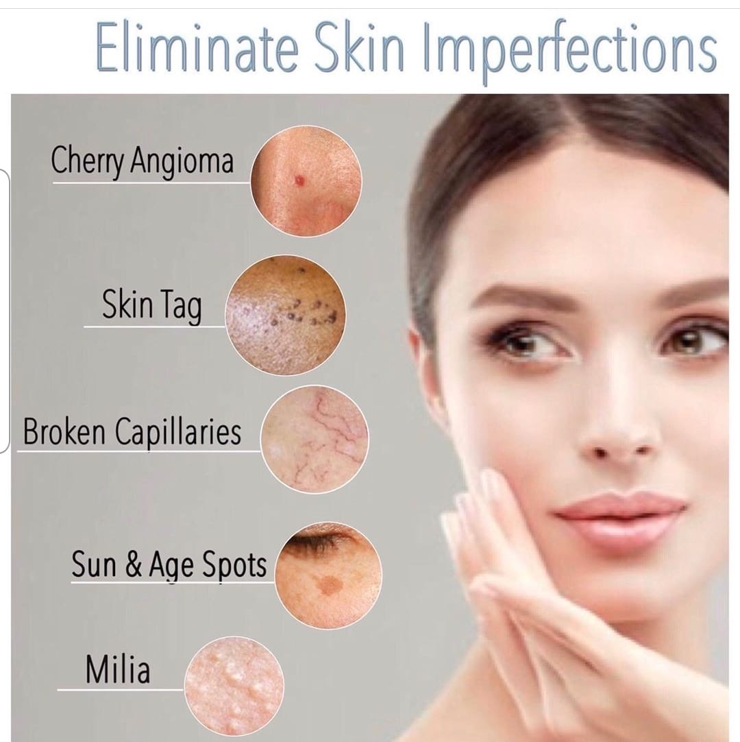 Eliminate Skin Imperfections